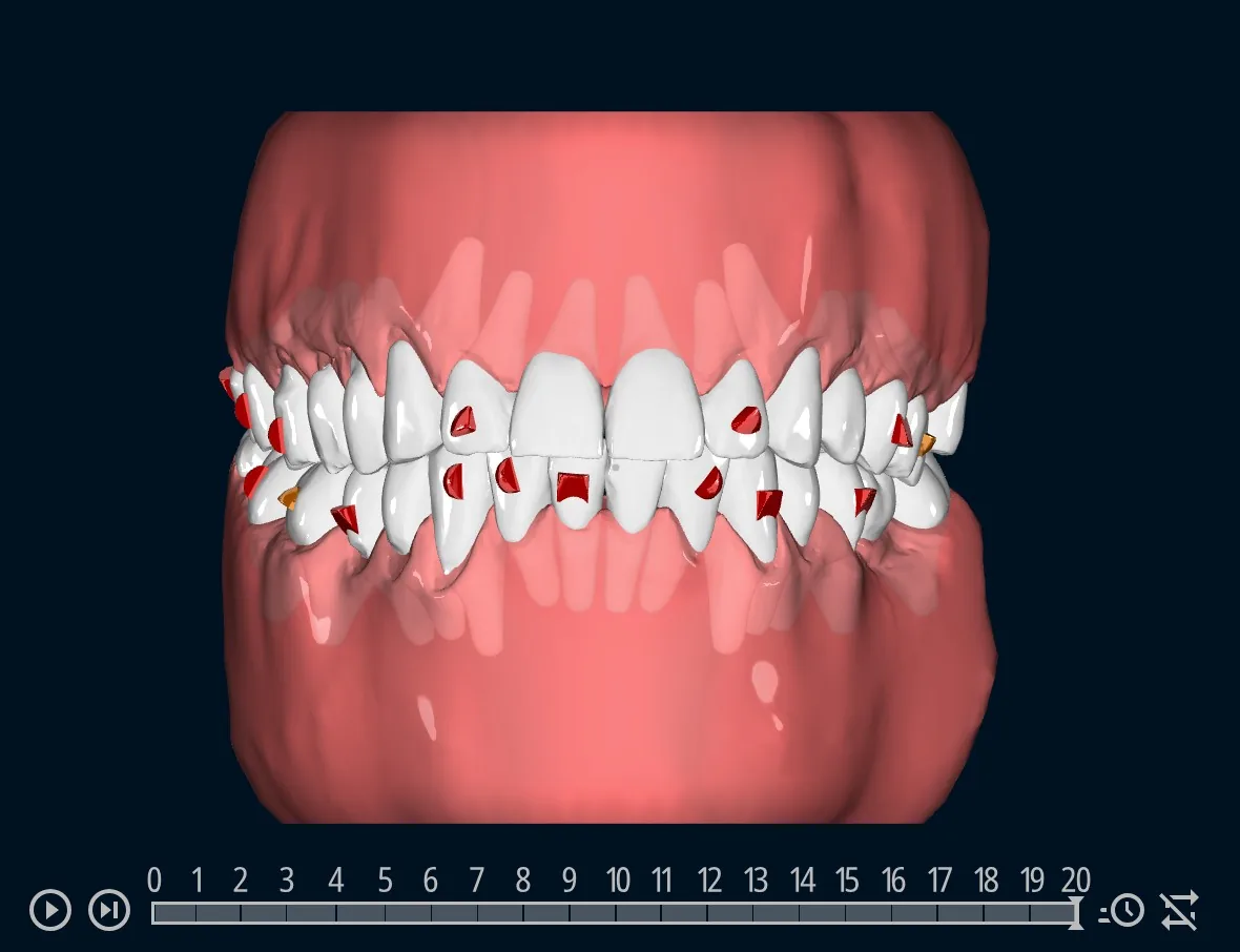 Viewer 3D OnyxCeph